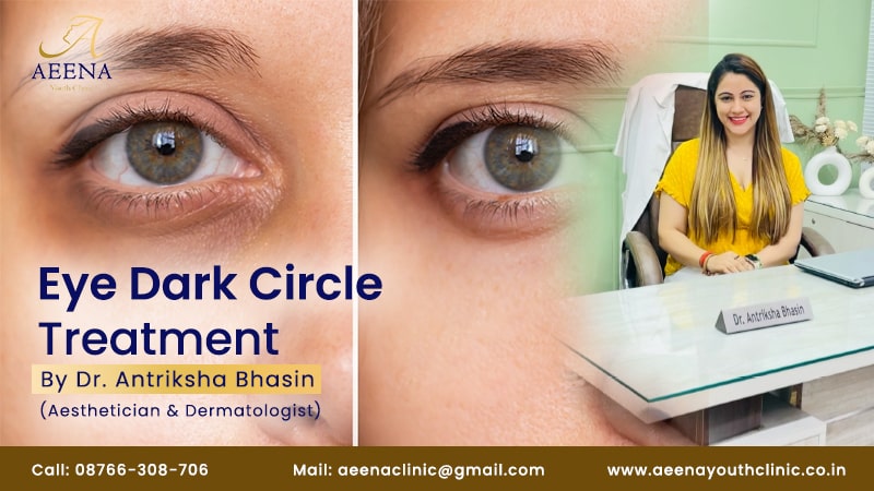 under-eye-dark-circle-treatment-best-doctor-dark-circle-cost-aeena-youth-clinic-antriksha-bhasin